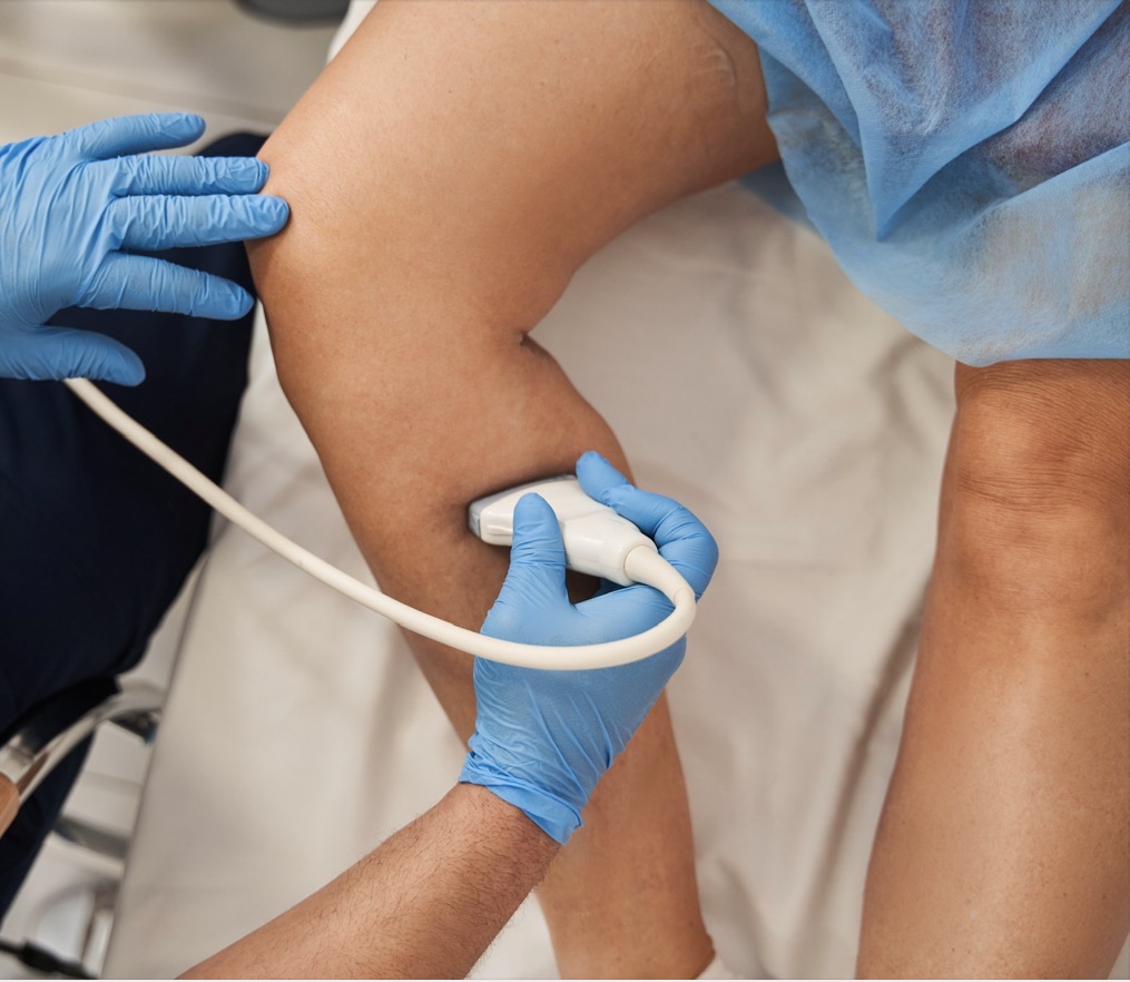 Vein & Vascular Treatments