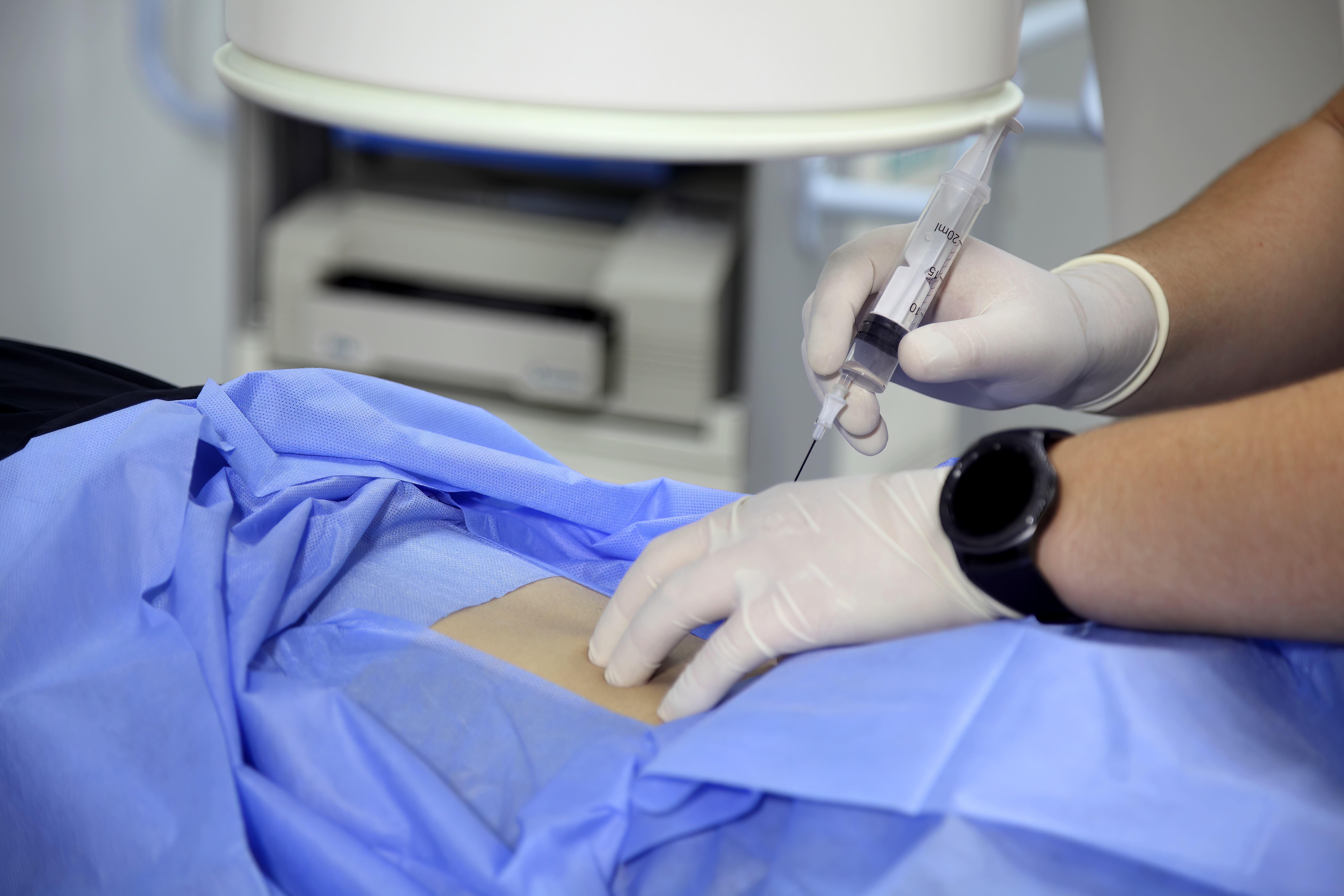 Fluoroscopy-guided facet joint injection