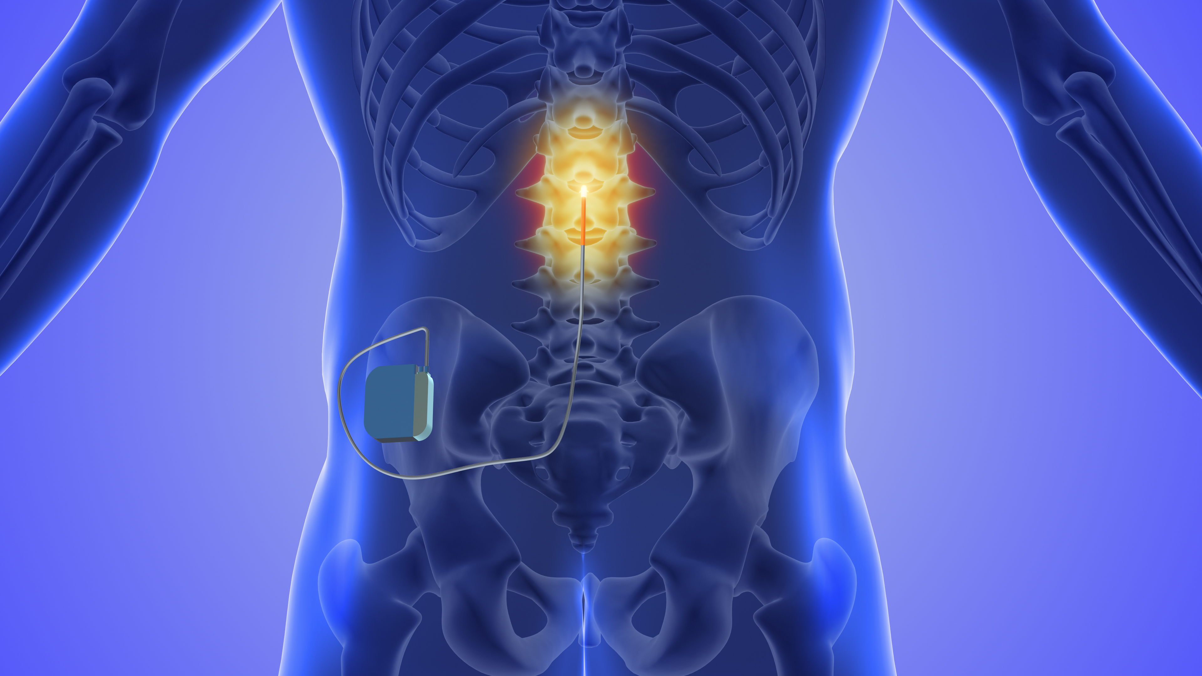 Advanced Surgical & Neuromodulation