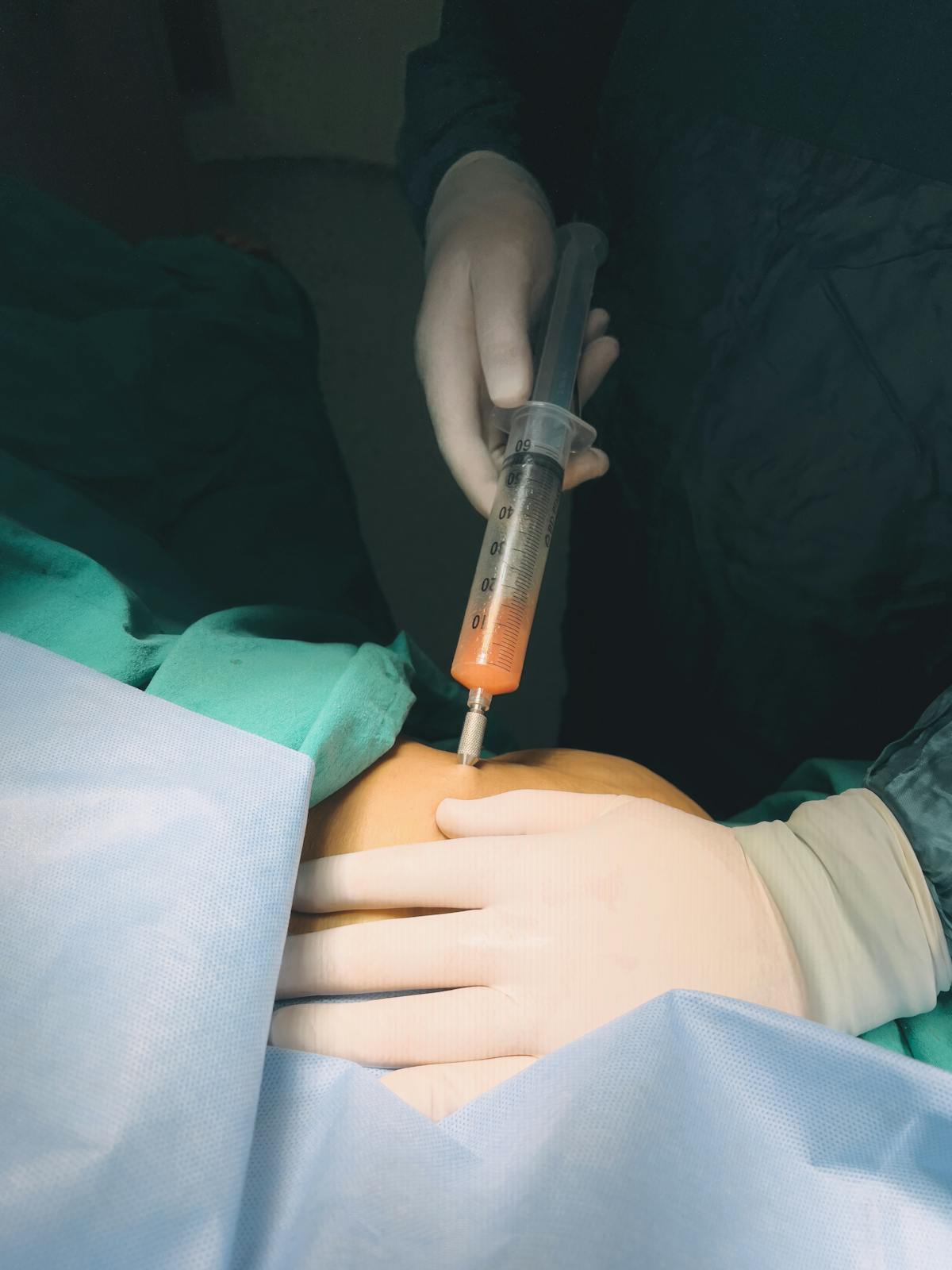 Provider performing peripheral nerve block injection